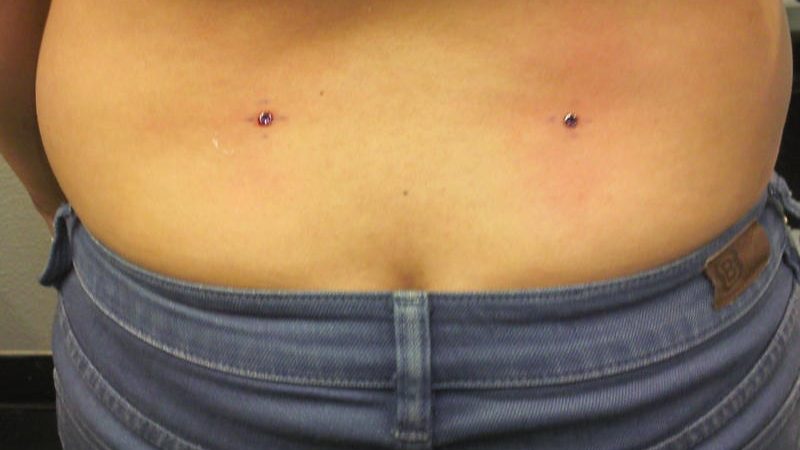 Back Dermal Piercing