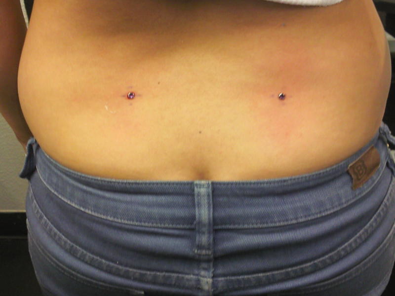 Back Dermal Piercing