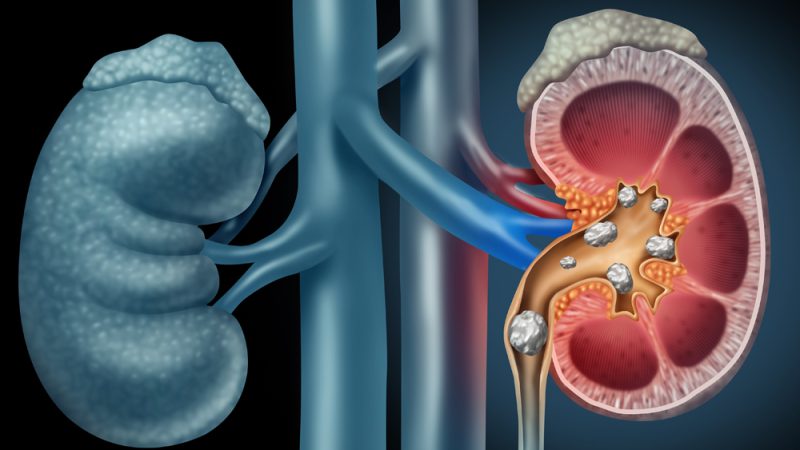 How Much Is a Kidney Worth? Exploring the Ethics, Economics, and Implications of Organ Trade